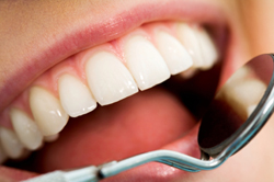 teeth getting looked over 