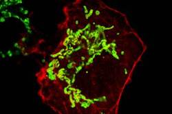 Microscopy and imaging