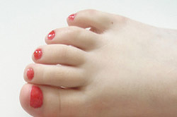 It is best to keep an eye on big toes