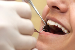 dental work