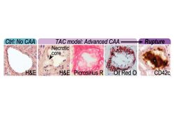 Ctrl: No CAA - TAC model: Advanced CAA - Rupture