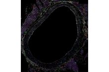 Mouse aorta