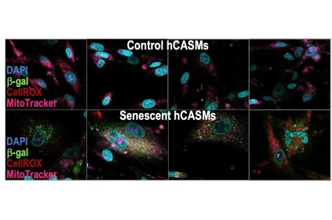 Control hCASMs vs Senscent hCASMs