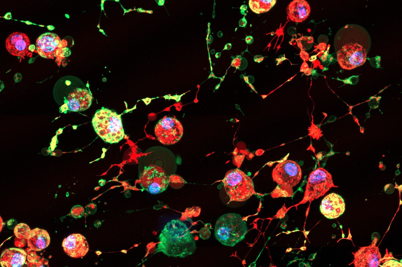 ’Footprint of Death’ gives new clues to cell life