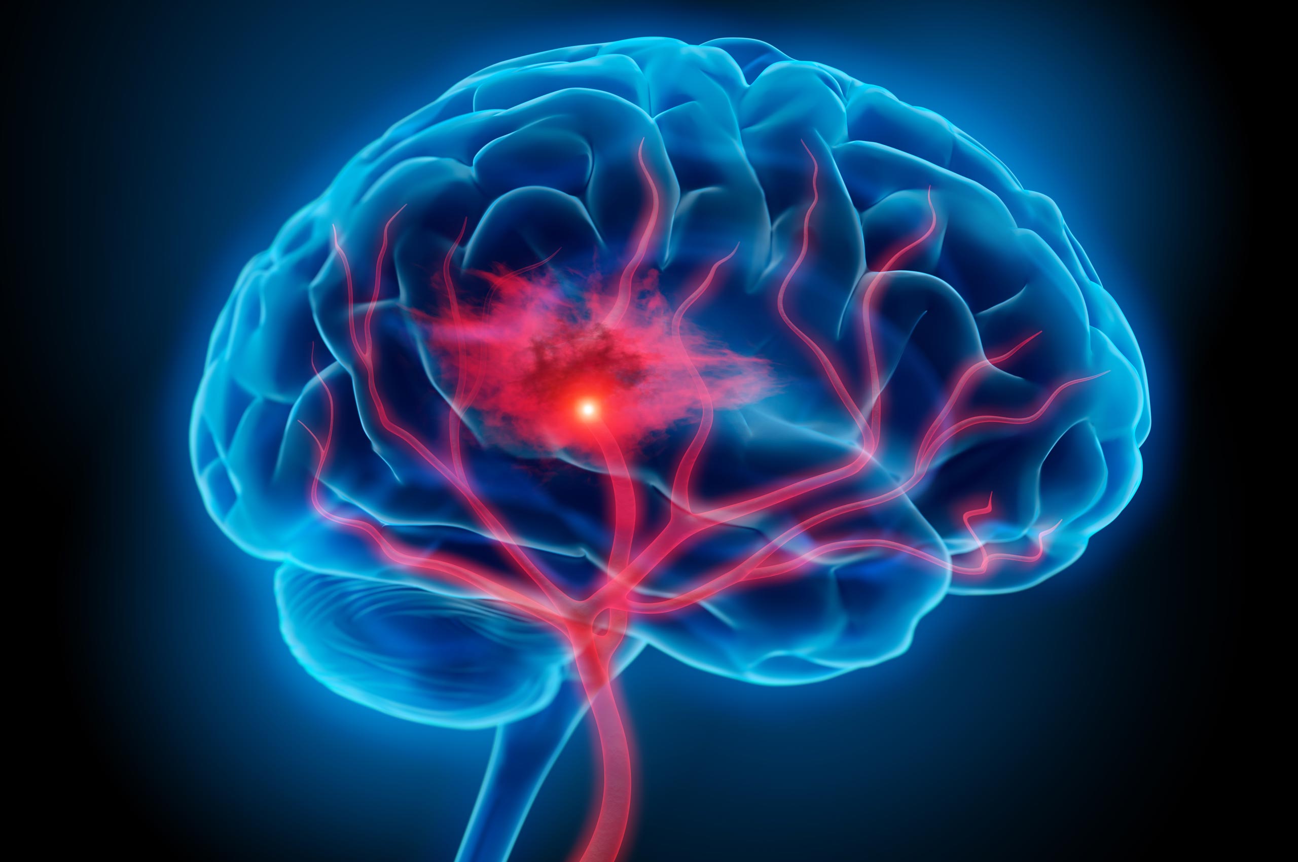 Brain diseases. Неврология мозг. Головной мозг неврология.